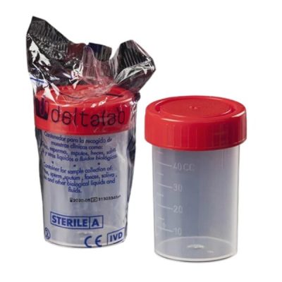 FRASCO20MUESTRA20DE20ORINA20100ML20TAPA20ROJA20-201041085-600x600
